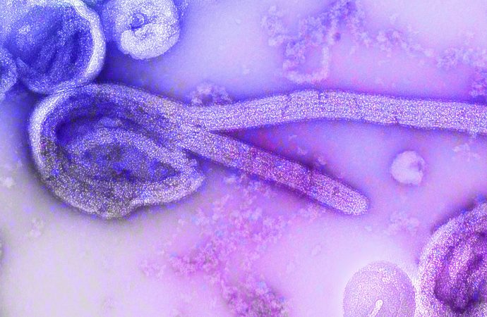 The Global Backstory to the Ebola Outbreak